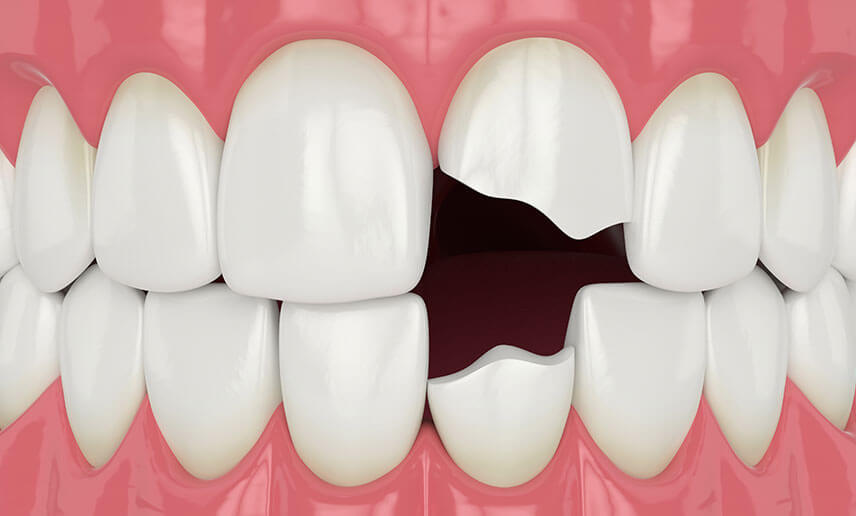 Chipped tooth found in chip packet Chipped tooth found in chip packet