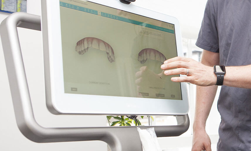 iTero™ and OrthoCAD iOC™ scanning systems iTero™ and OrthoCAD iOC™ scanning systems