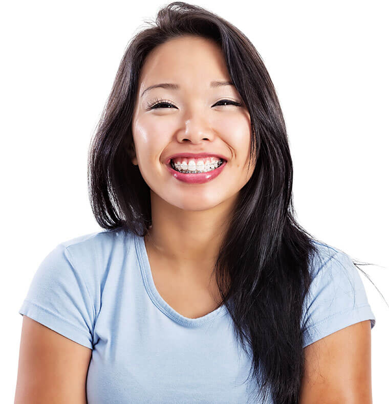 How do braces work How do braces work